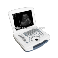 DW-580 portable laptop B/W ultrasound machine price full digital ultrasound scanner from Dawei ultrasound